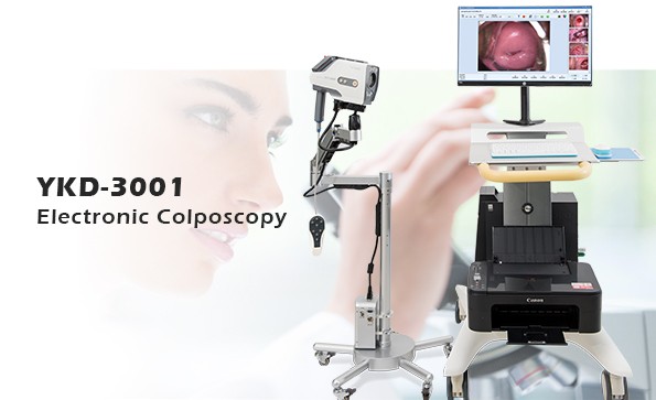 Introduction of colposcopy manufacturers: What is an electronic colposcopy? Electronic colposcopy steps