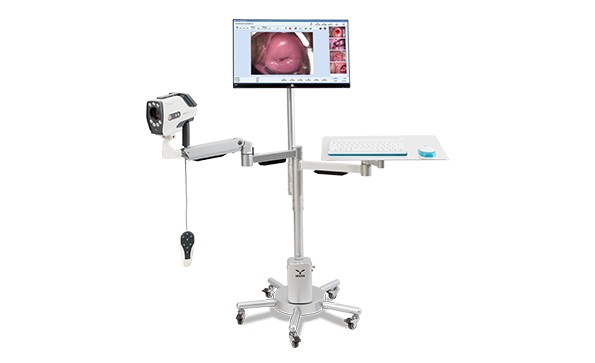 What is a digital electronic colposcope?