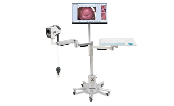 Sony Sensor Digital Colposcope For Gynecology
