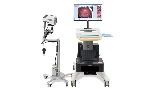 The development prospects of electronic colposcopy