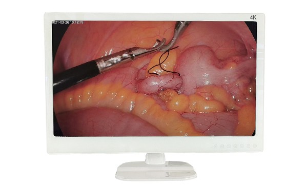 What should be paid attention to in the maintenance of endoscope monitor