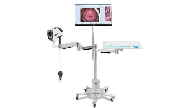 How does the electronic colposcopy work?