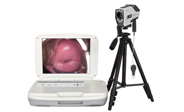 What is the electronic colposcopy?