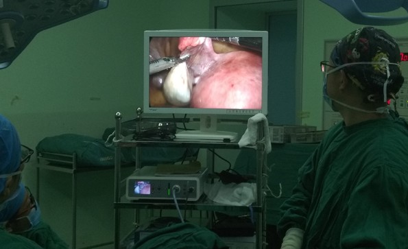 Principles and indications of laparoscopic surgery