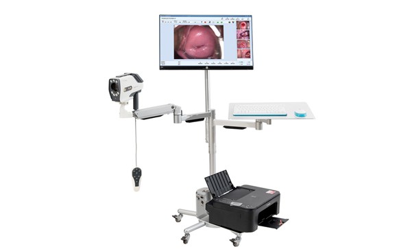 Full HD Digital  Colposcope Equipment designed by IKEDA