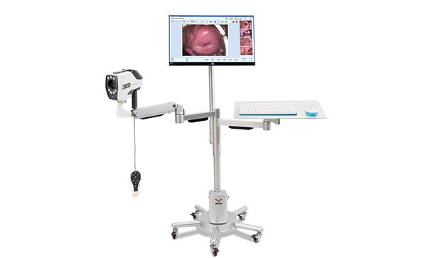 The difference between digital colposcope and vaginal color Doppler ultrasound