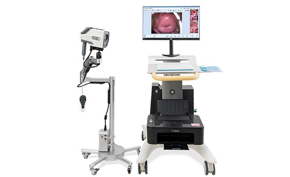 How much is a colposcopy machine?