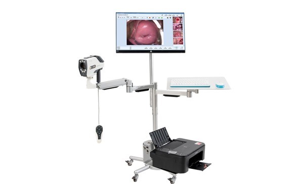 Do I need to take a biopsy for digital colposcopy?