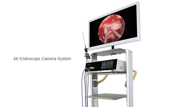 Why Choose 4K Ultra HD Endoscope Camera System