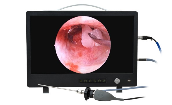 What are the anti-fogging methods for the endoscope camera?