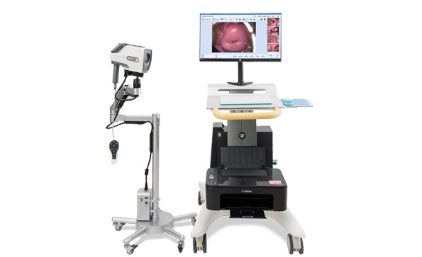 The difference between digital video colposcope and optical colposcope