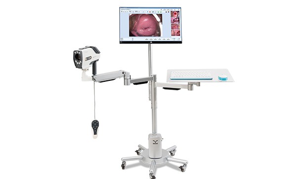What is a digital colposcope? What does it do?