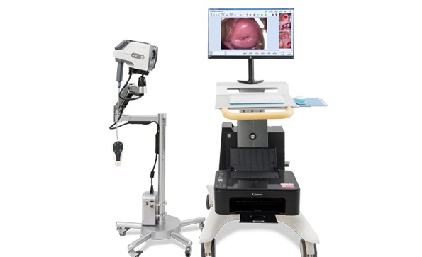 Digital Video Colposcope Method