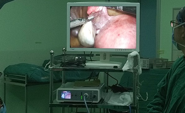 【Gynecological Laparoscopy】Laparoscopic cholecystectomy