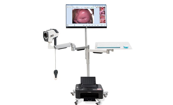 Application of Digital Video Colposcopy in Cervical Diseases