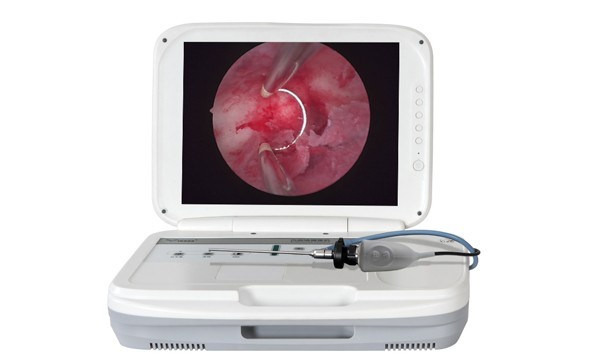 Clinical Application Of Hysteroscope