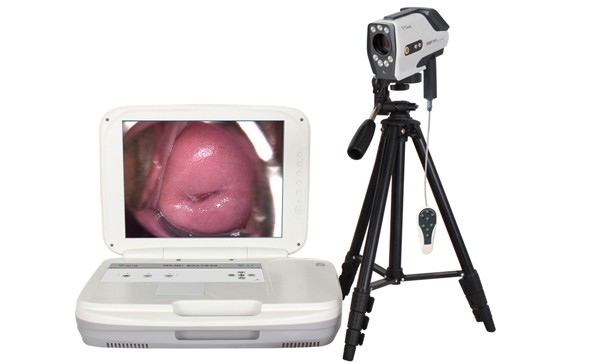 Are Colposcopy And Colposcopy Biopsy The Same Thing