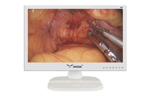 What are the differences between Medical Displays and Ordinary Displays?