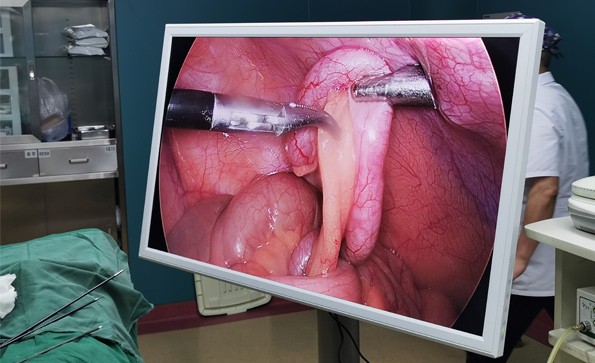  55 inch 4K Medical Monitor Designed By YIKEDA