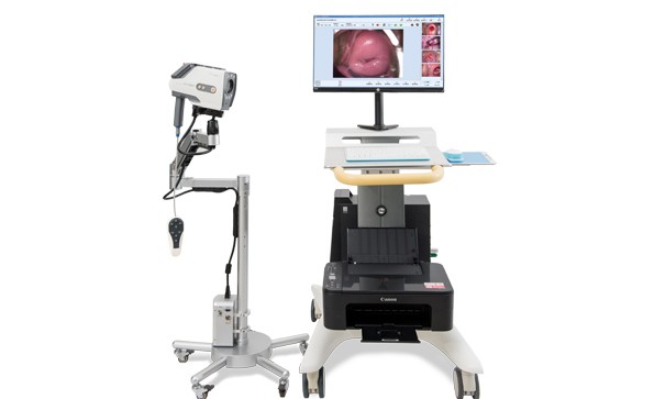 Digital Colposcope And TCT Technology To Diagnose Early Cervical Cancer