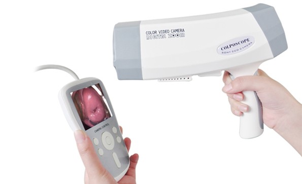 How To Choose A Digital Colposcope Camera?