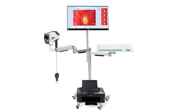 Operation Steps Of Digital Colposcope