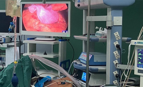 4K Ultra HD Endoscope Camera System Clinical Operation Application