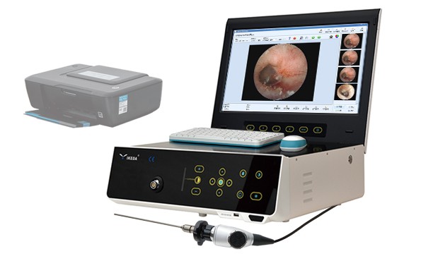 Application of rigid tube nasal endoscope in throat examination and operation