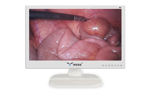 Yikeda 32-inch 4K Medical Monitor Is Packaged And Shipped