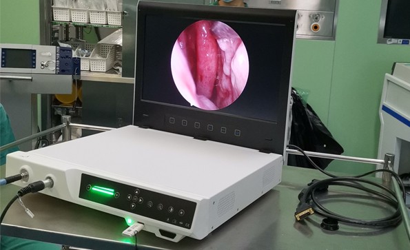 【Hysteroscopy】Intubation of fallopian tube orifice under hysteroscopy