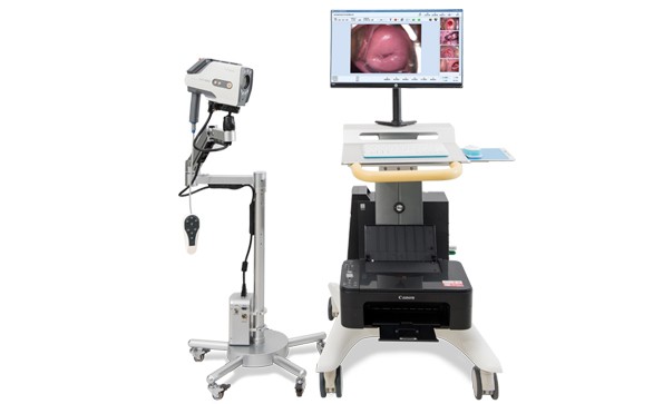 What to pay attention to during digital colposcopy?
