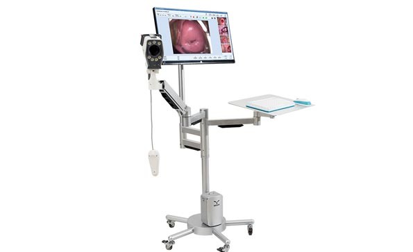 YIKEDA Digital Colposcope Installation Machine