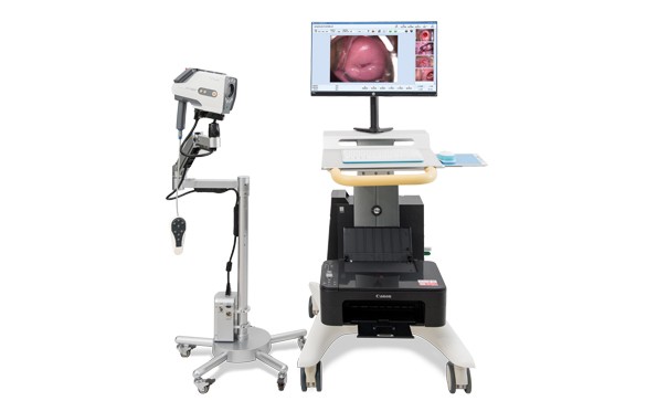 YIKEDA Digital Electronic Colposcopy Hospital Installation