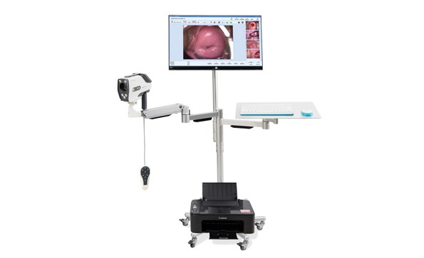 Is Digital Video Colposcopy Harmful?