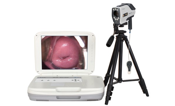 How to choose a portable colposcope manufacturer？