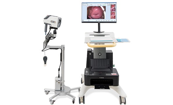 IKEDA HD digital colposcope packaged and shipped