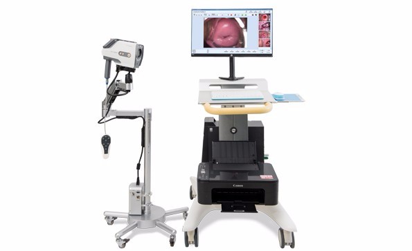 The main factors affecting the accuracy of colposcopy