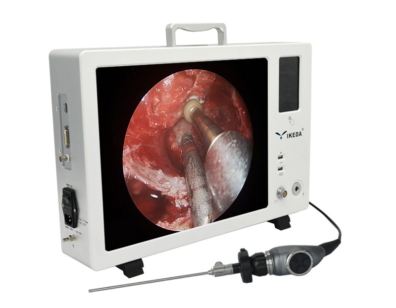 YKD-9115T FULL HD Endoscope Camera System