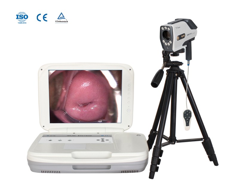 YKD-3004 Portable Digital Colposcope