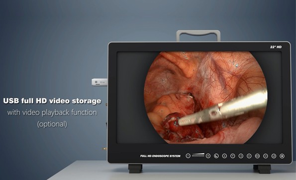 Video storage operation method of endoscope camera