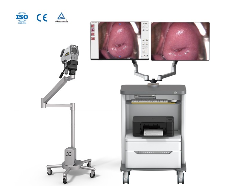 YKD-3002 HD Digital Electronic Colposcope