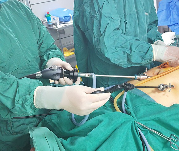 Laparoscopy Surgery