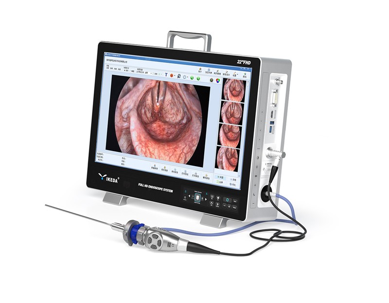 YKD-9122H ALL-IN-ONE Endoscope Camera System
