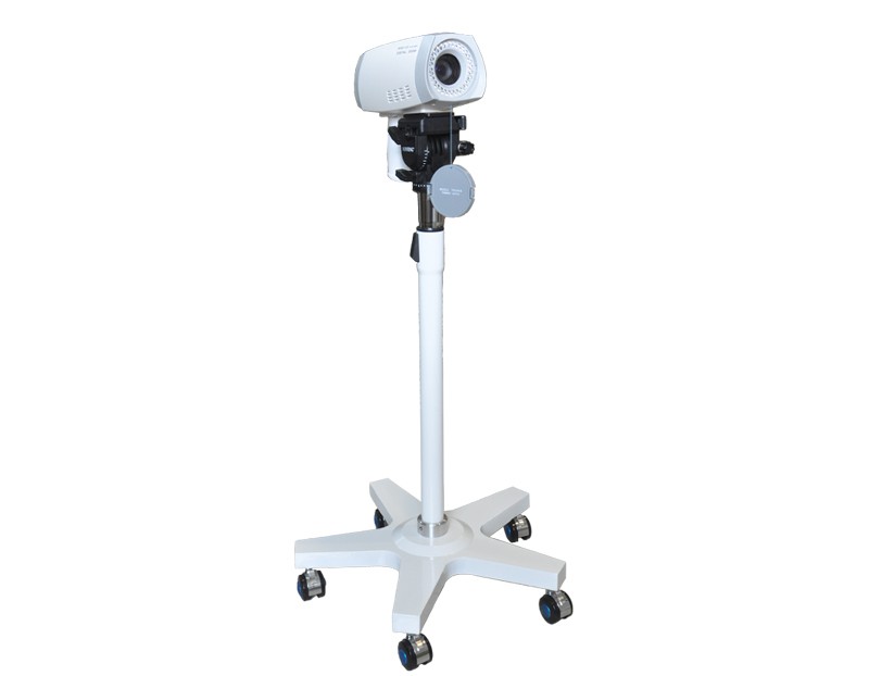 Portable Digital Video Colposcope Camera