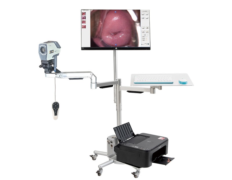 YKD-3003 HD Digital Video Colposcope