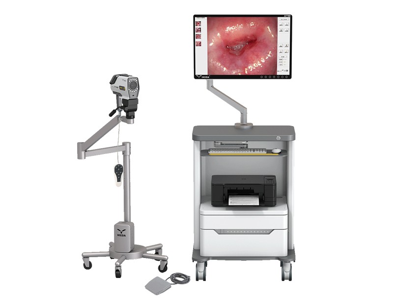 YKD-3001 HD Digital Video Colposcope